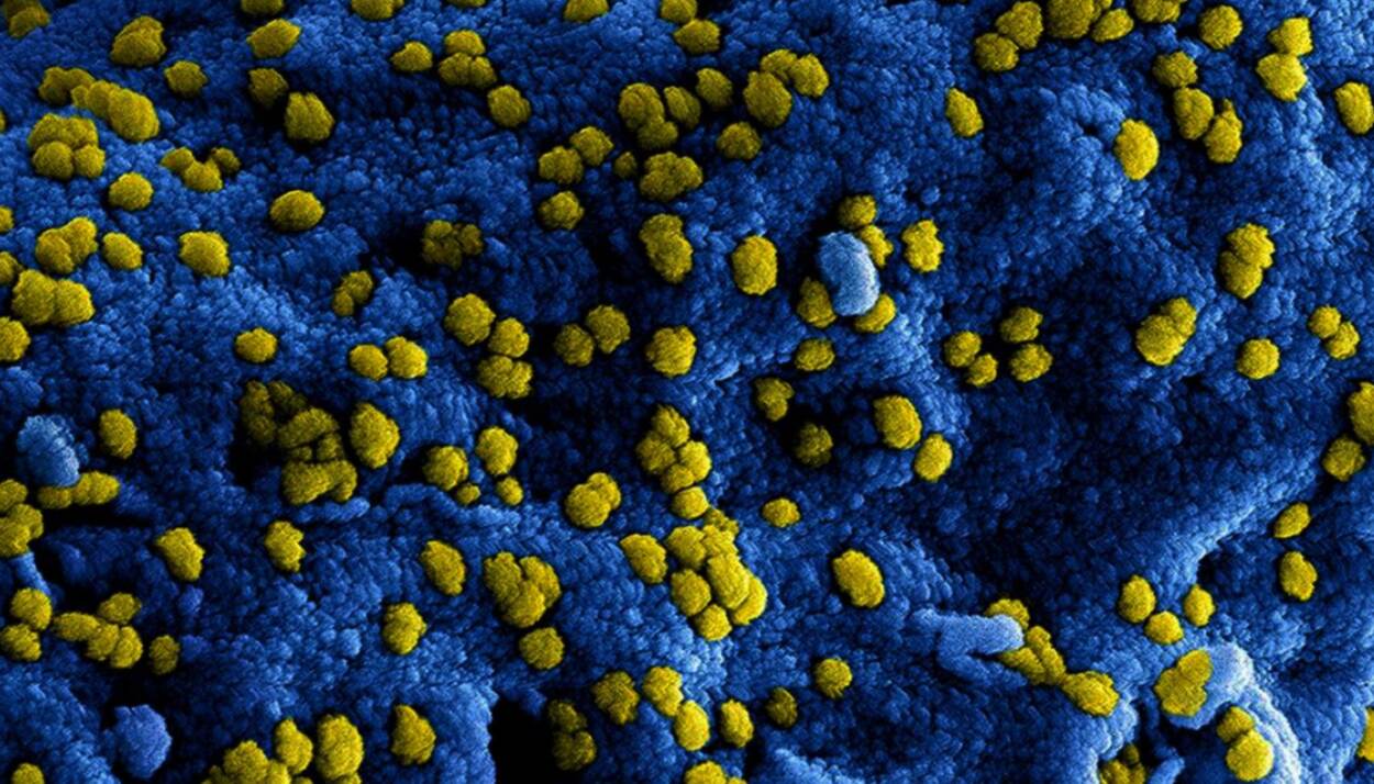 Microscopische foto van het coronavirus